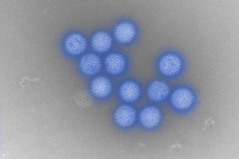 Bluetongue Virus Detected in Kent