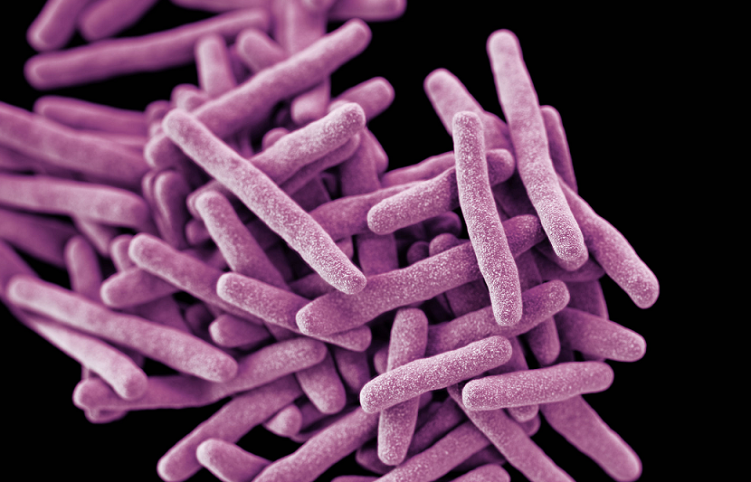 UKHSA Calls for a Renewed Effort to Tackle TB