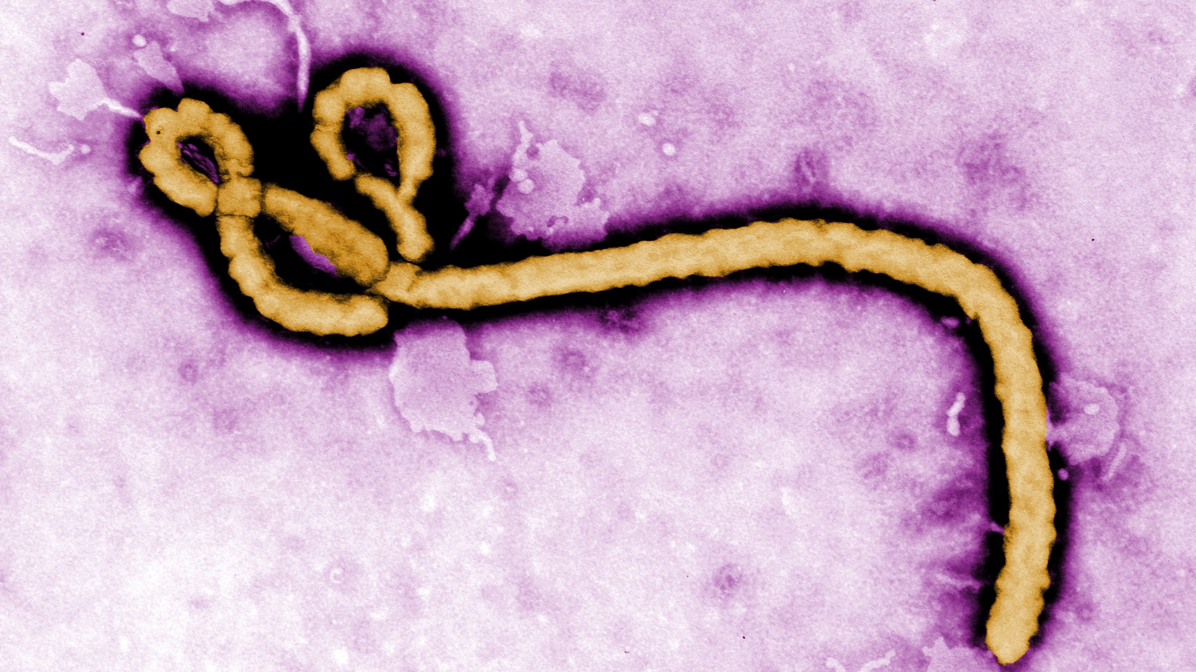 United States Responds to Ebola Outbreak in Africa